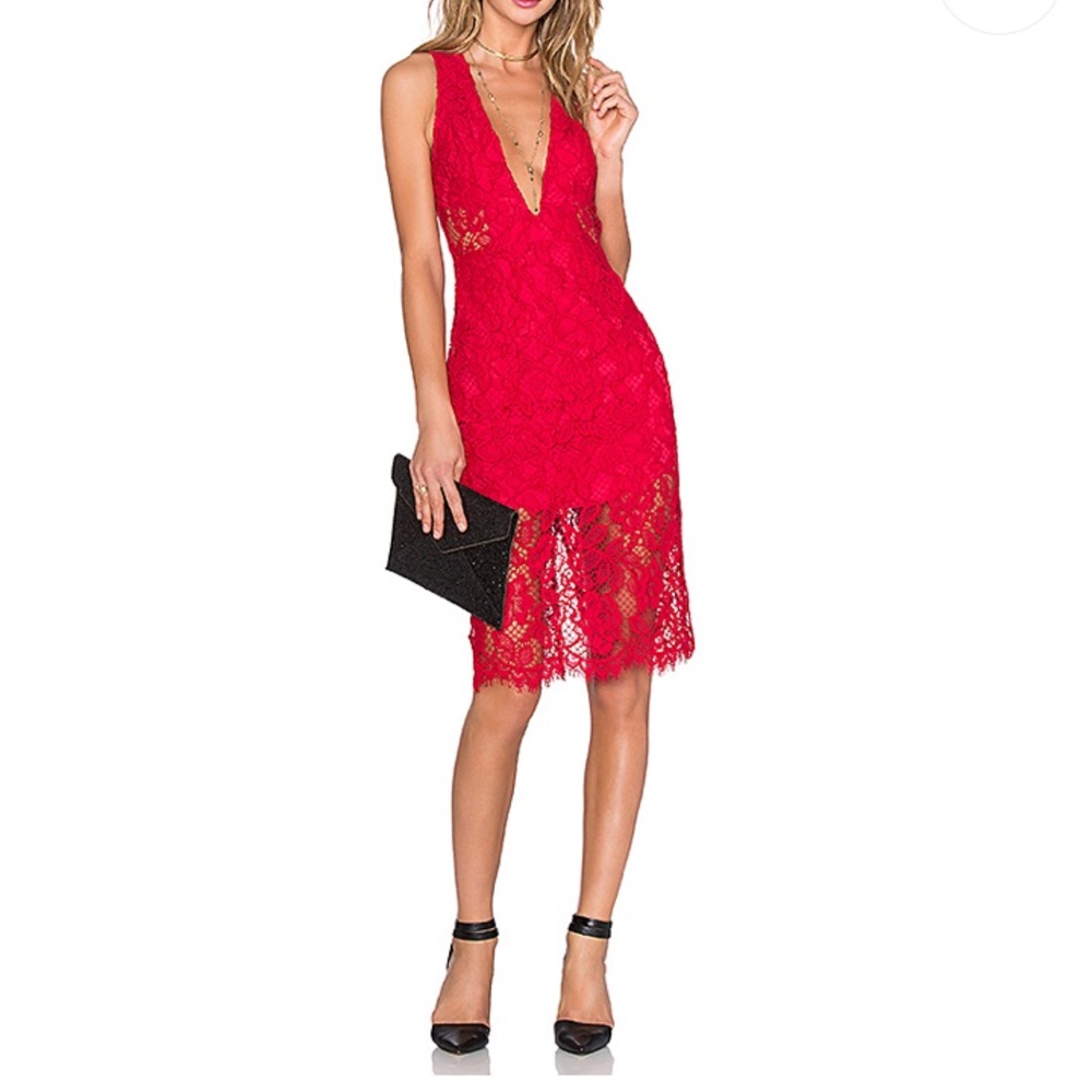 NBD dress